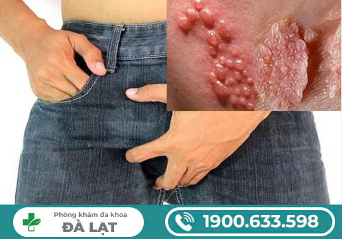 Hình ảnh minh họa